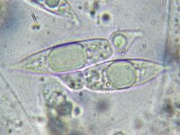 Anthostomella rubicola 1, Braamschoorsteentje, Micro, Saxifraga-Lucien Rommelaars