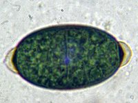 Arnium apiculatum 1, Klitspinselbolletje, Micro, Saxifraga-Lucien Rommelaars