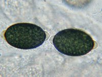 Arnium apiculatum 4, Klitspinselbolletje, Micro, Saxifraga-Lucien Rommelaars
