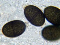 Arnium apiculatum 7, Klitspinselbolletje, Micro, Saxifraga-Lucien Rommelaars