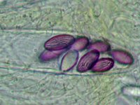 Ascobolus furfuraceus 3, Gewoon spikkelschijfje, Micro, Saxifraga-Lucien Rommelaars