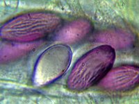 Ascobolus furfuraceus 4, Gewoon spikkelschijfje, Micro, Saxifraga-Lucien Rommelaars