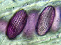 Ascobolus furfuraceus 5, Gewoon spikkelschijfje, Micro, Saxifraga-Lucien Rommelaars
