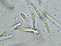 Belonopsis retincola 10, Rietviltmollisia, Micro, Saxifraga-Lucien Rommelaars