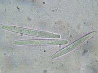 Cordyceps longisegmentis 1, Grootsporige truffelknotszwam, Micro, Saxifraga-Lucien Rommelaars