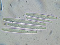 Cordyceps longisegmentis 2, Grootsporige truffelknotszwam, Micro, Saxifraga-Lucien Rommelaars