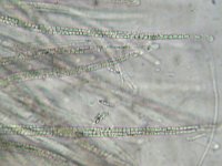 Cordyceps ophioglossoides 6, Zwarte truffelknotszwam, Micro, Saxifraga-Lucien Rommelaars