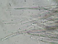 Cordyceps ophioglossoides 7, Zwarte truffelknotszwam, Micro, Saxifraga-Lucien Rommelaars