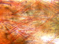 Dematioscypha dematiicola 1, Donker franjekelkje, Micro, Saxifraga-Lucien Rommelaars