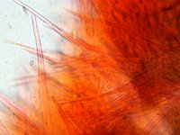 Dematioscypha dematiicola 2, Donker franjekelkje, Micro, Saxifraga-Lucien Rommelaars