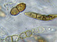 Didymosphaeria conoidea 3, Micro, Saxifraga-Lucien Rommelaars