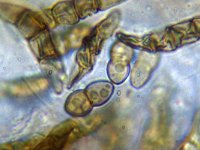 Didymosphaeria conoidea 4, Micro, Saxifraga-Lucien Rommelaars