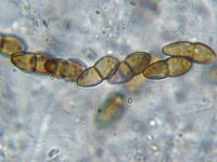 Didymosphaeria conoidea 5, Micro, Saxifraga-Lucien Rommelaars
