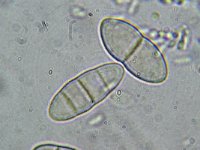 Gibberella sp 1, Micro, Saxifraga-Lucien Rommelaars