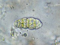 Gloniopsis praelonga 2, Braamspleetlip, Micro, Saxifraga-Lucien Rommelaars