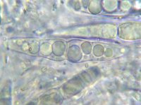 Herpotrichia herpotrichoides 3, Micro, Saxifraga-Lucien Rommelaars
