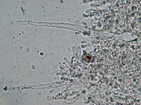 Hyphoderma argillaceum 3, Fijnharig harskorstje, Micro, Saxifraga-Lucien Rommelaars