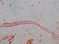 Hyphoderma argillaceum 4, Fijnharig harskorstje, Micro, Saxifraga-Lucien Rommelaars