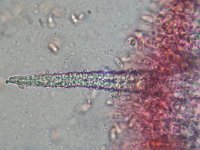 Hyphoderma puberum 2, Fluwelig harskorstje, Micro, Saxifraga-Lucien Rommelaars