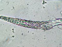 Hyphoderma puberum 5, Fluwelig harskorstje, Micro, Saxifraga-Lucien Rommelaars