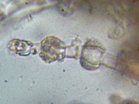 Hyphodontia pallidula 3, Kleinsporige wrattentandjeszwam, Micro, Saxifraga-Lucien Rommelaars
