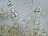 Hyphodontia pallidula 5, Kleinsporige wrattentandjeszwam, Micro, Saxifraga-Lucien Rommelaars