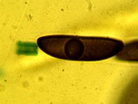 Hypoxylon mammatum 1, Micro, Saxifraga-Lucien Rommelaars