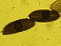 Hypoxylon mammatum 2, Micro, Saxifraga-Lucien Rommelaars