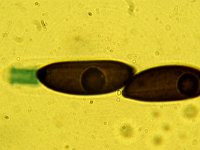 Hypoxylon mammatum 3, Micro, Saxifraga-Lucien Rommelaars