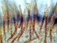 Lasiobelonium nidulum 1, Gladharig franjekelkje,  Micro, Saxifraga-Lucien Rommelaars