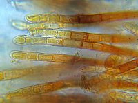 Lasiobelonium nidulum 2, Gladharig franjekelkje,  Micro, Saxifraga-Lucien Rommelaars