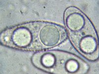 Leucoscypha leucotricha 2, Wit viltkogeltje, Micro, Saxifraga-Lucien Rommelaars