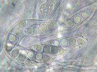 Lophiotrema nucula 1, Micro, Saxifraga-Lucien Rommelaars