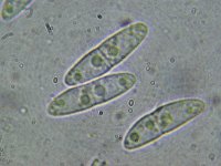 Nectriella dacrymycella 1, Micro, Saxifraga-Lucien Rommelaars