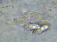 Nectriella funicola 1, Micro, Saxifraga-Lucien Rommelaars