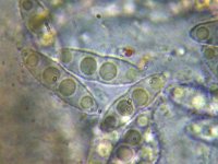 Nectriella funicola 2, Micro, Saxifraga-Lucien Rommelaars