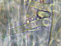 Nectriella funicola 4, Micro, Saxifraga-Lucien Rommelaars