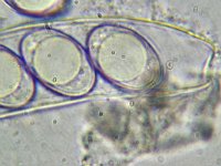 Octospora humosa 1, Micro, Saxifraga-Lucien Rommelaars