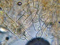 Octospora humosa 5, Micro, Saxifraga-Lucien Rommelaars