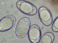 Octospora humosa 8, Micro, Saxifraga-Lucien Rommelaars