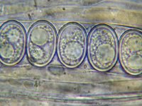 Pachyella babbingtonii 3, Okerbruin beekschijfje, Micro, Saxifraga-Lucien Rommelaars