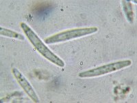 Paradidymella clarkii 1, Micro, Saxifraga-Lucien Rommelaars