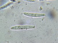 Paradidymella clarkii 2, Micro, Saxifraga-Lucien Rommelaars