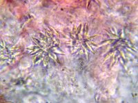 Resinicium bicolor 1, Kristaltandjeszwam, Micro, Saxifraga-Lucien Rommelaars