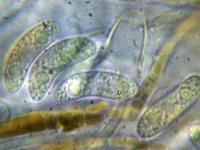 Rutstroemia echinophila 6, Kastanjestromakelkje, Micro, Saxifraga-Lucien Rommelaars