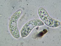 Rutstroemia echinophila 7, Kastanjestromakelkje, Micro, Saxifraga-Lucien Rommelaars