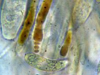 Rutstroemia echinophila 8, Kastanjestromakelkje, Micro, Saxifraga-Lucien Rommelaars