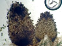 Schizothecium squamulosum 1, Micro, Saxifraga-Lucien Rommelaars