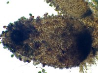 Schizothecium squamulosum 2, Micro, Saxifraga-Lucien Rommelaars