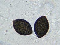 Schizothecium squamulosum 8, Micro, Saxifraga-Lucien Rommelaars